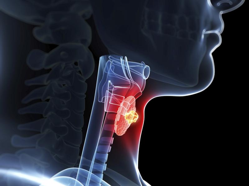 Endocrine Diseases